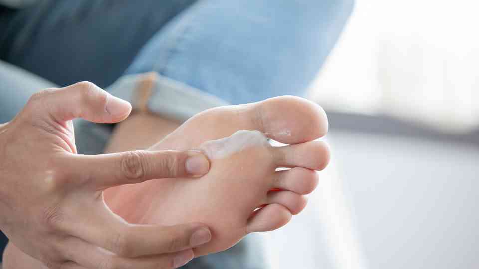 athlete's foot cream