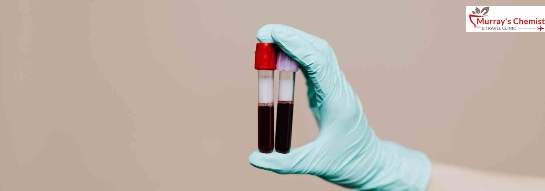 person wearing medical glove holding blood tests